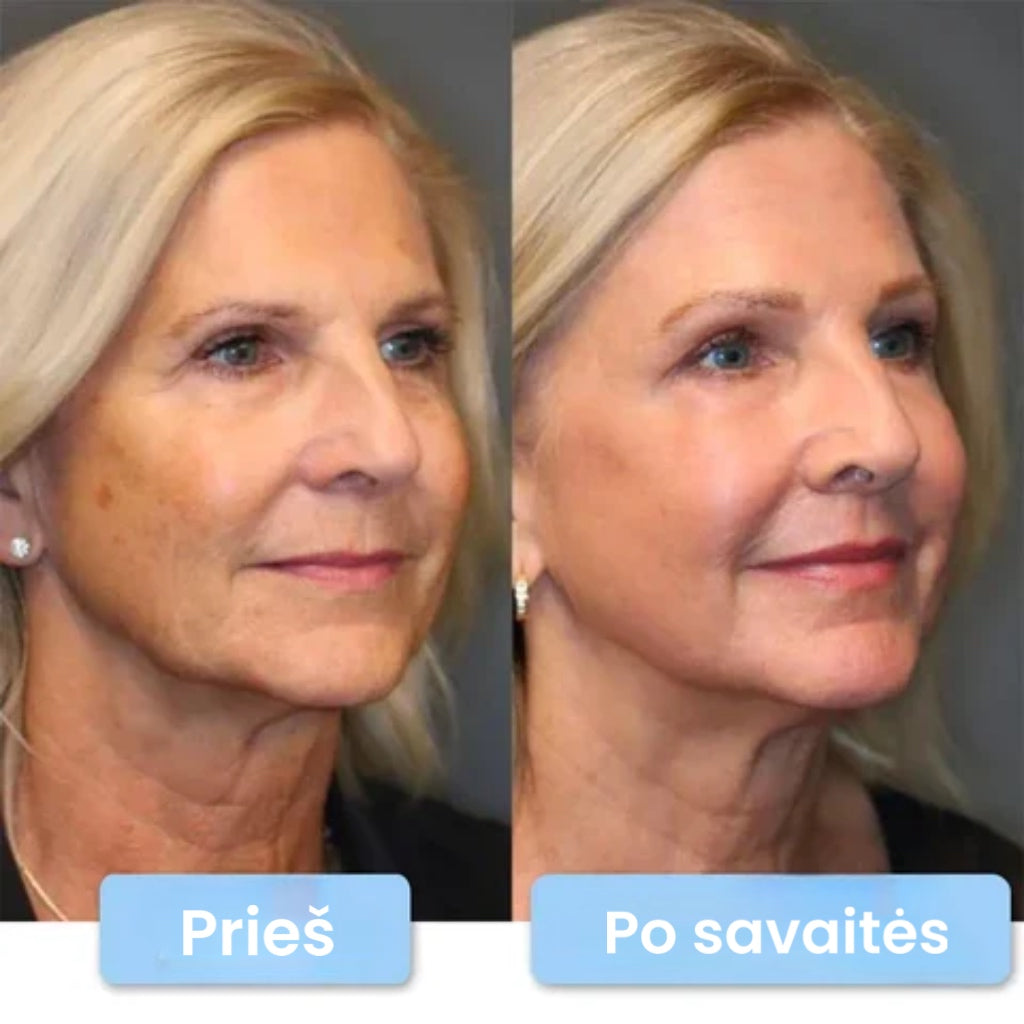 "The Botox" jauninatis veido serumas